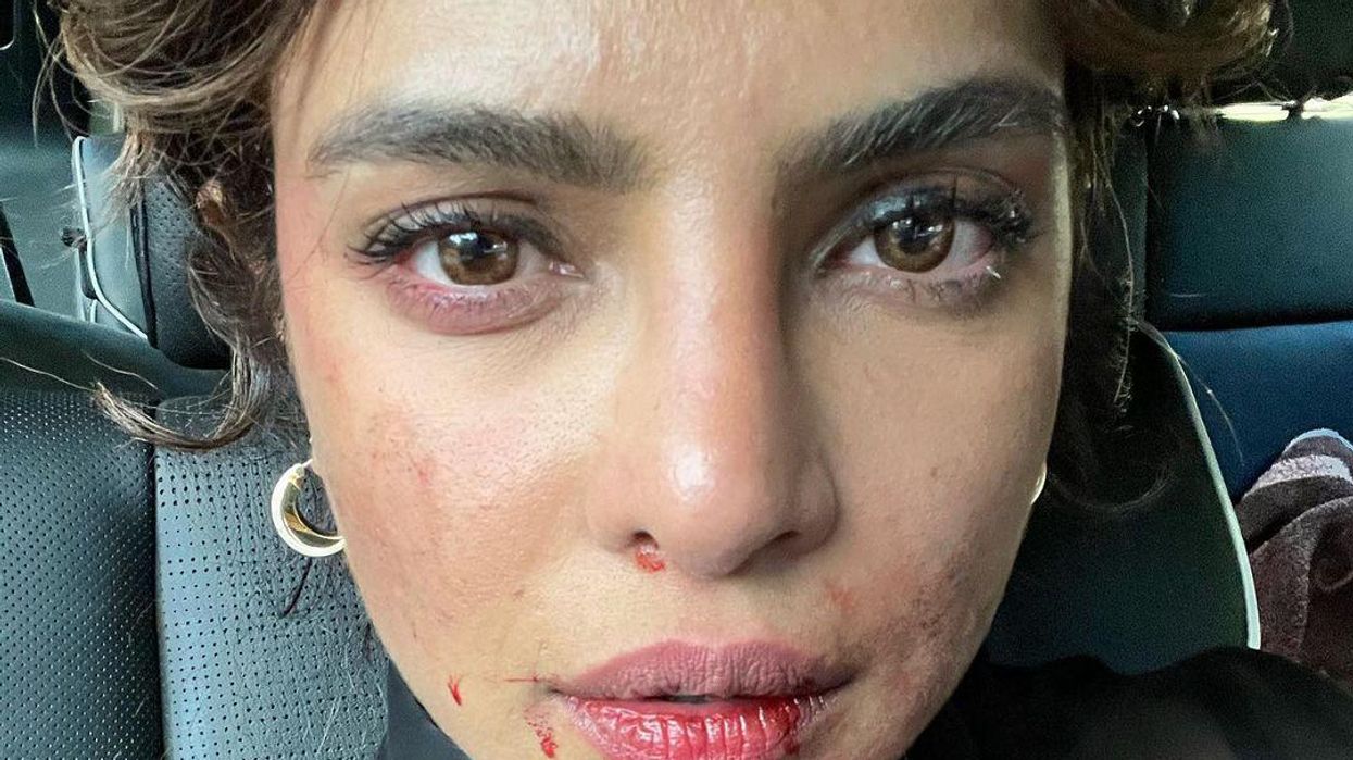 Priyanka Chopra Jonas Concerns Fans With New Selfie