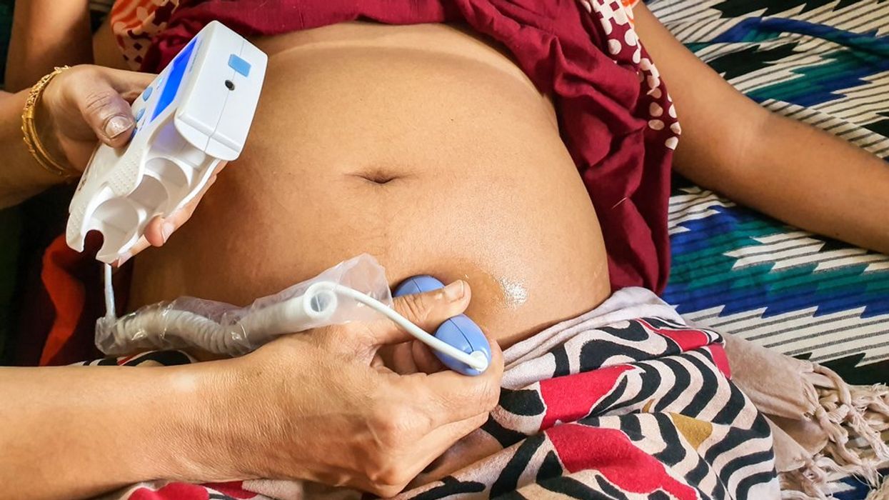 Maternal mortality rates