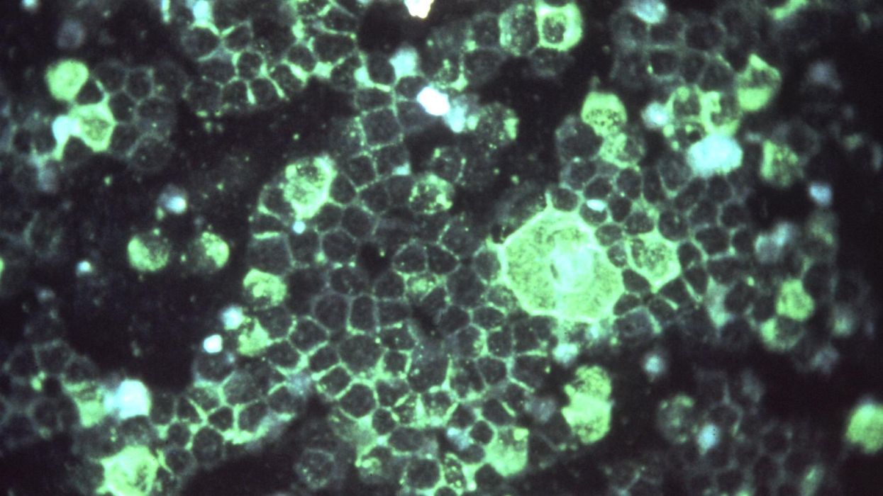 RSV microscope image
