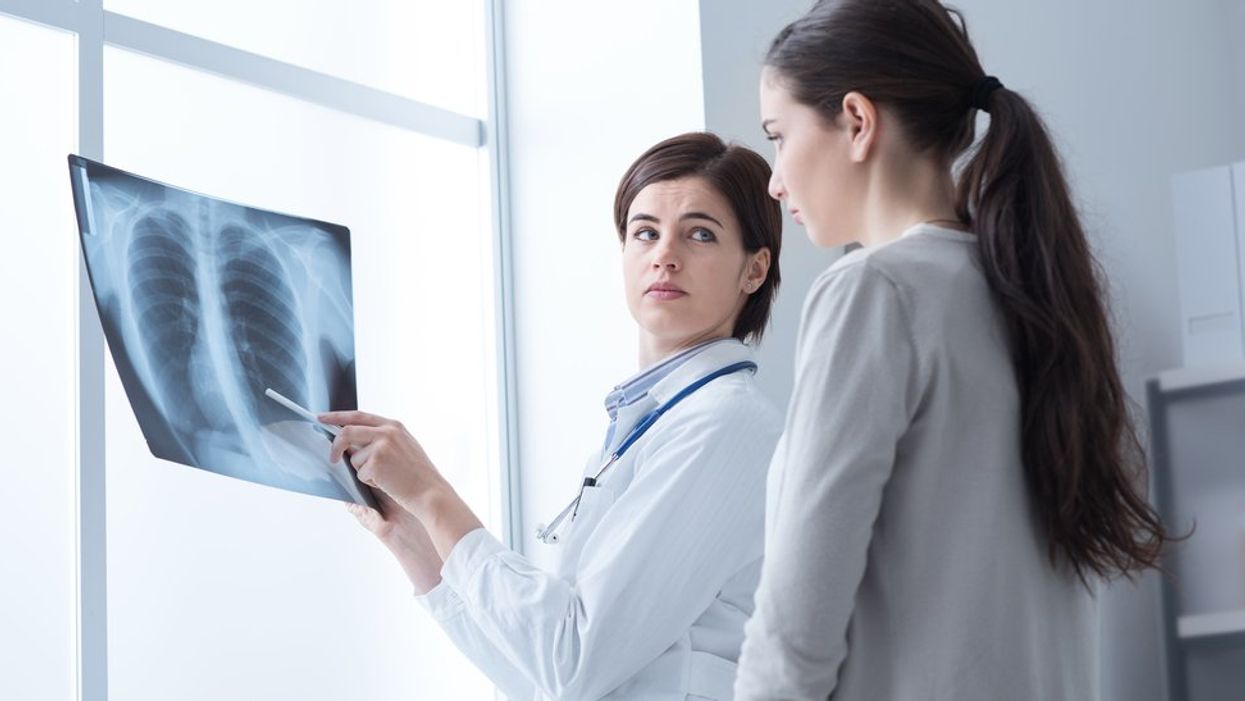 Women Have Higher Rates of Lung Cancer Than Men, and Researchers Are Baffled