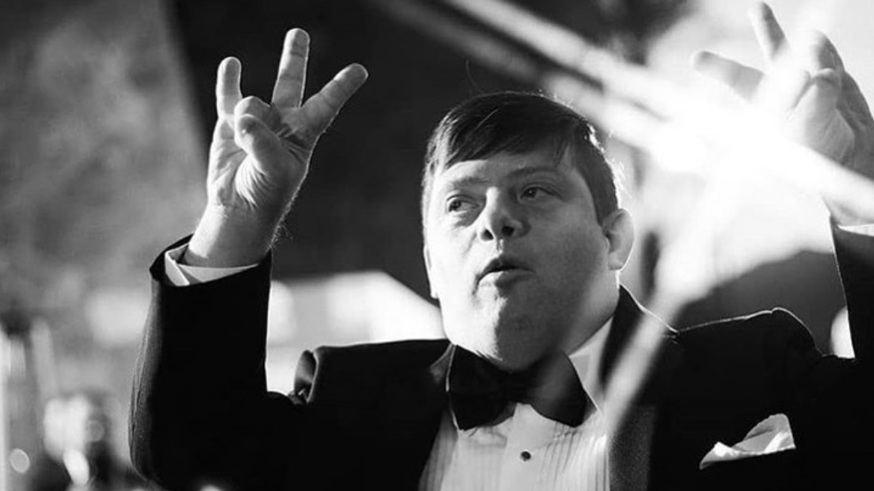 Representation Spotlight: Pioneers In Entertainment With Down Syndrome